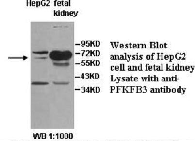 PFK2 / PFKFB3 Antibody