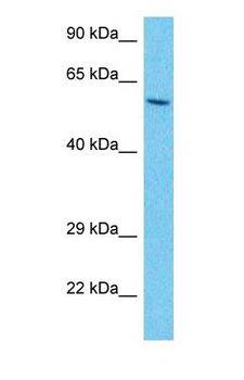 PFK2 / PFKFB3 Antibody - Western blot of F263 Antibody with human Thymus Tumor lysate.  This image was taken for the unconjugated form of this product. Other forms have not been tested.