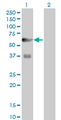 PFK2 / PFKFB3 Antibody - Western Blot analysis of PFKFB3 expression in transfected 293T cell line by PFKFB3 monoclonal antibody (M08), clone 3F3.Lane 1: PFKFB3 transfected lysate(59.6 KDa).Lane 2: Non-transfected lysate.