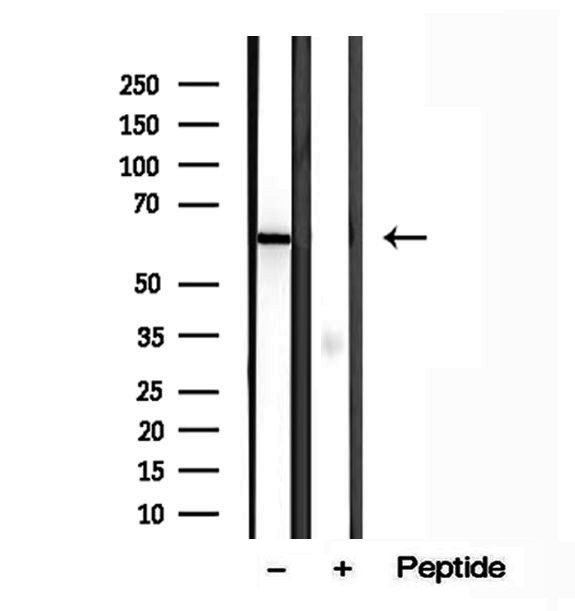 PFK2 / PFKFB3 Antibody - Western blot analysis of extracts of A549 cells using PFKFB3-Specific antibody.