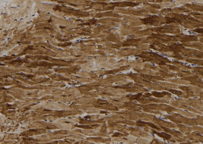 PFK2 / PFKFB3 Antibody - 1:100 staining rat heart tissue by IHC-P. The sample was formaldehyde fixed and a heat mediated antigen retrieval step in citrate buffer was performed. The sample was then blocked and incubated with the antibody for 1.5 hours at 22°C. An HRP conjugated goat anti-rabbit antibody was used as the secondary.