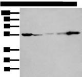 PFK2 / PFKFB3 Antibody - Western blot analysis of 293T A549 A431 Hela and Jurkat cell lysates  using PFKFB3 Polyclonal Antibody at dilution of 1:400