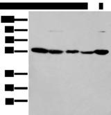 PFK2 / PFKFB3 Antibody - Western blot analysis of 293T cell lysates  using PFKFB3 Polyclonal Antibody at dilution of 1:200