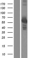 PFK2 / PFKFB3 Protein - Western validation with an anti-DDK antibody * L: Control HEK293 lysate R: Over-expression lysate