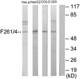 PFKFB1+4 Antibody - Western blot analysis of lysates from HeLa, HepG2, COLO205, and 293 cells, using PFKFB1/4 Antibody. The lane on the right is blocked with the synthesized peptide.