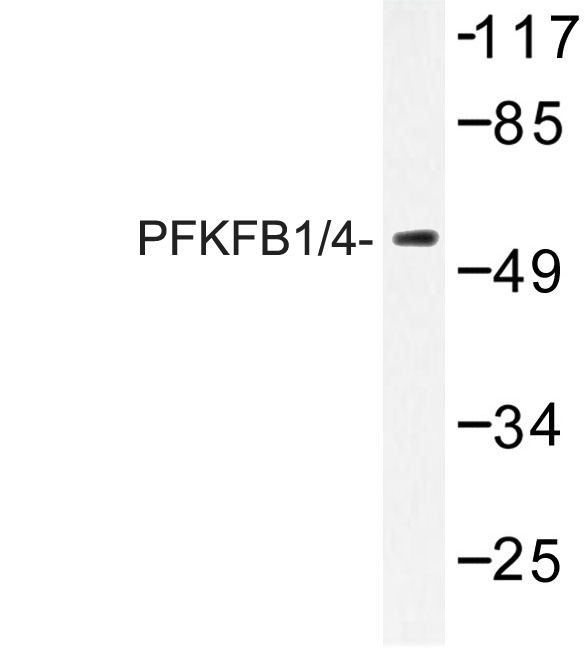 PFKFB1+4 Antibody - Western blot of PFKFB1/4 (E349) pAb in extracts from HeLa cells.