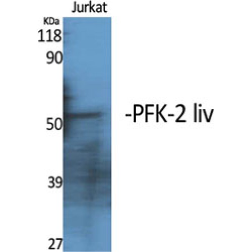 PFKFB1 Antibody - Western blot of PFK-2 liv antibody