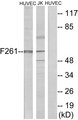 PFKFB1 Antibody - Western blot analysis of lysates from HUVEC cells and Jurkat cells, using PFKFB1 Antibody. The lane on the right is blocked with the synthesized peptide.