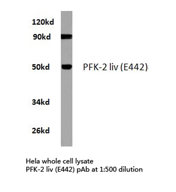 PFKFB1 Antibody - Western blot of PFK-2 liv (E442) pAb in extracts from HeLa cells.