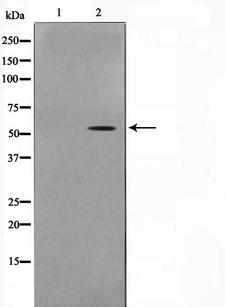PFKFB1 Antibody - Western blot analysis on HeLa cell lysates using PFKFB1/4 antibody