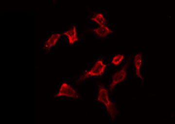 PFKFB1 Antibody - Staining HeLa cells by IF/ICC. The samples were fixed with PFA and permeabilized in 0.1% Triton X-100, then blocked in 10% serum for 45 min at 25°C. The primary antibody was diluted at 1:200 and incubated with the sample for 1 hour at 37°C. An Alexa Fluor 594 conjugated goat anti-rabbit IgG (H+L) Ab, diluted at 1/600, was used as the secondary antibody.