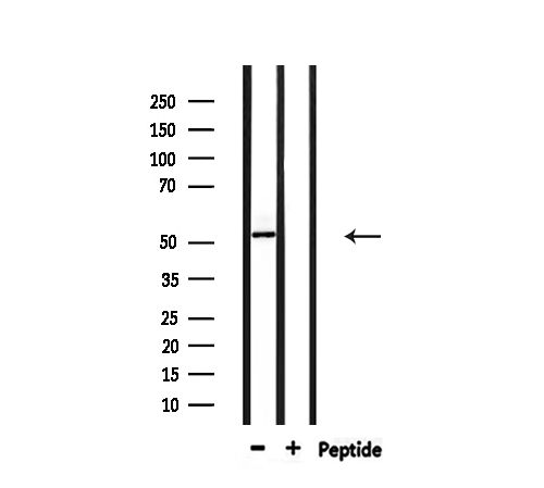 PFKFB1 Antibody - Western blot analysis of extracts of 293 cells using PFKFB1/4 antibody.