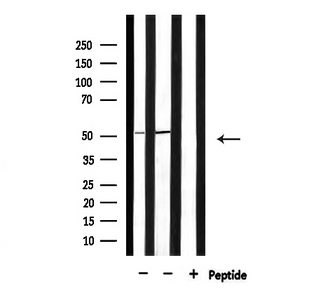 PFKFB1 Antibody