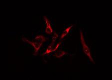 PFKFB1 Antibody - Staining HuvEc cells by IF/ICC. The samples were fixed with PFA and permeabilized in 0.1% Triton X-100, then blocked in 10% serum for 45 min at 25°C. The primary antibody was diluted at 1:200 and incubated with the sample for 1 hour at 37°C. An Alexa Fluor 594 conjugated goat anti-rabbit IgG (H+L) antibody, diluted at 1/600, was used as secondary antibody.