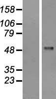 PFKFB1 Protein - Western validation with an anti-DDK antibody * L: Control HEK293 lysate R: Over-expression lysate