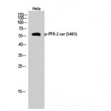 PFKFB2 Antibody - Western blot of Phospho-PFK-2 car (S483) antibody