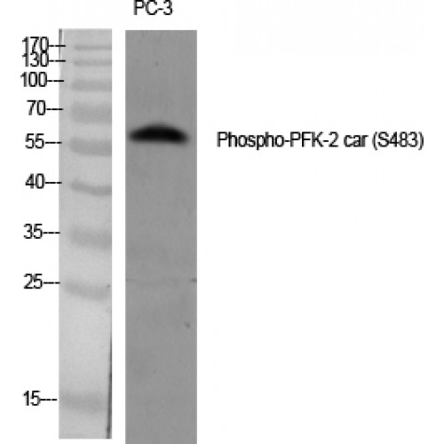 PFKFB2 Antibody - Western blot of Phospho-PFK-2 car (S483) antibody