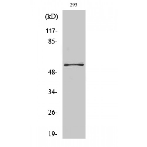 PFKFB2 Antibody - Western blot of PFK-2 car antibody