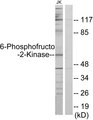 PFKFB2 Antibody - Western blot analysis of lysates from Jurkat cells, using PFKFB2 Antibody. The lane on the right is blocked with the synthesized peptide.