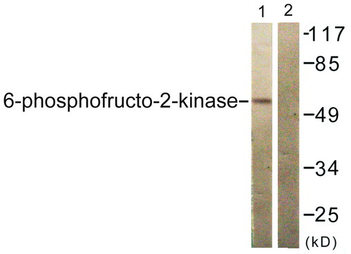 PFKFB2 Antibody - Western blot analysis of lysates from 293 cells, treated with Heat shock, using PFKFB2 Antibody. The lane on the right is blocked with the synthesized peptide.