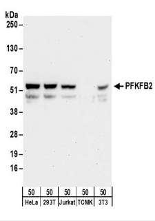 PFKFB2 Antibody - Detection of Human and Mouse PFKFB2 by Western Blot. Samples: Whole cell lysate (50 ug) from HeLa, 293T, Jurkat, mouse TCMK-1, and mouse NIH3T3 cells. Antibodies: Affinity purified rabbit anti-PFKFB2 antibody used for WB at 0.1 ug/ml. Detection: Chemiluminescence with an exposure time of 30 seconds.
