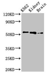 PFKFB2 Antibody - Western Blot Positive WB detected in: K562 whole cell lysate, Rat kidney tissue, Rat brain tissue All lanes: PFKFB2 antibody at 3µg/ml Secondary Goat polyclonal to rabbit IgG at 1/50000 dilution Predicted band size: 59, 55 kDa Observed band size: 55 kDa