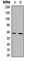 PFKFB2 Antibody - Western blot analysis of PFKFB2 expression in HCT116 (A); NIH3T3 (B) whole cell lysates.
