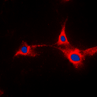 PFKFB2 Antibody - Immunofluorescent analysis of PFKFB2 staining in HepG2 cells. Formalin-fixed cells were permeabilized with 0.1% Triton X-100 in TBS for 5-10 minutes and blocked with 3% BSA-PBS for 30 minutes at room temperature. Cells were probed with the primary antibody in 3% BSA-PBS and incubated overnight at 4 deg C in a humidified chamber. Cells were washed with PBST and incubated with a DyLight 594-conjugated secondary antibody (red) in PBS at room temperature in the dark. DAPI was used to stain the cell nuclei (blue).