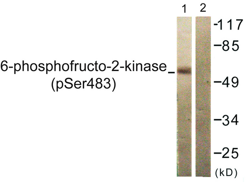 PFKFB2 Antibody - Western blot analysis of lysates from 293 cells treated with Heat shock, using PFKFB2 (Phospho-Ser483) Antibody. The lane on the right is blocked with the phospho peptide.