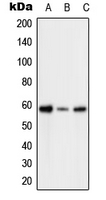 PFKFB2 Antibody - Western blot analysis of PFKFB2 (pS483) expression in HeLa H2O2-treated (A); SP2/0 H2O2-treated (B); H9C2 H2O2-treated (C) whole cell lysates.