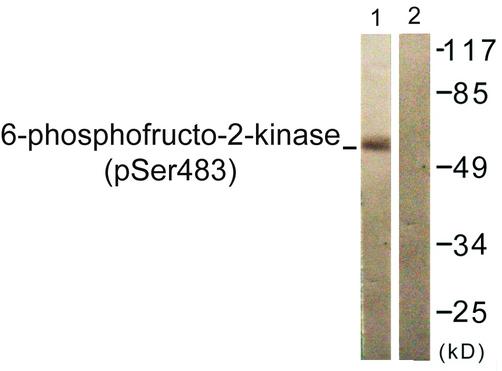 PFKFB2 Antibody - Western blot analysis of extracts from 293 cells, treated with Heat shock, using PFKFB2 (Phospho-Ser483) antibody.