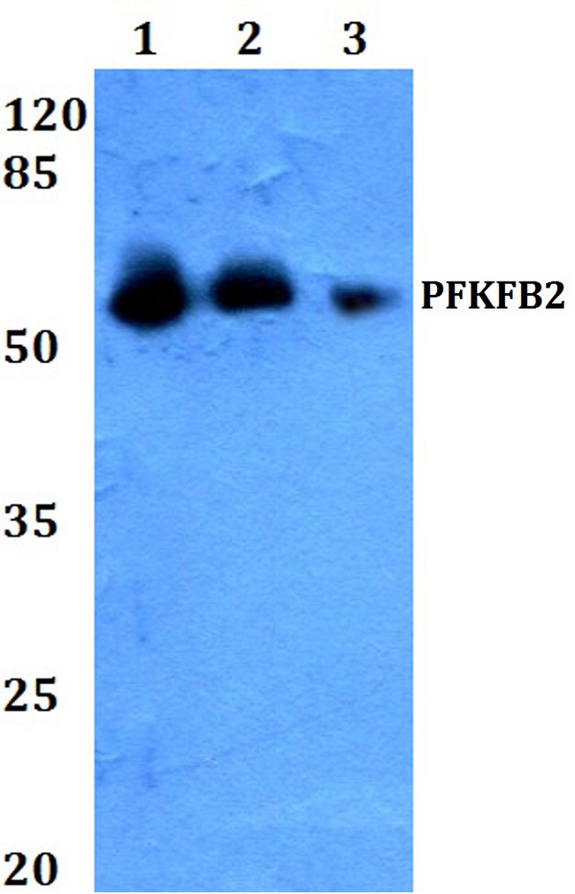 PFKFB2 Antibody - Western blot analysis of Anti-PFKRB2 Antibody at a 1:500 dilution. Lane 1: HEK293T whole cell lysate. Lane 2: Raw264.7 whole cell lysate. Lane 3: PC12 whole cell lysate.