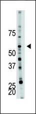 PFKFB4 Antibody - The anti-PFKFB4 antibody is used in Western blot to detect PFKFB4 in mouse brain tissue lysate.