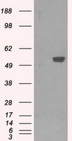 PFKFB4 Antibody - HEK293T cells were transfected with the pCMV6-ENTRY control (Left lane) or pCMV6-ENTRY PFKFB4 (Right lane) cDNA for 48 hrs and lysed. Equivalent amounts of cell lysates (5 ug per lane) were separated by SDS-PAGE and immunoblotted with anti-PFKFB4.