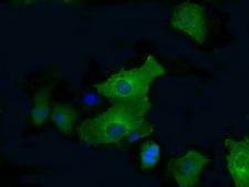 PFKFB4 Antibody - Anti-PFKFB4 mouse monoclonal antibody  immunofluorescent staining of COS7 cells transiently transfected by pCMV6-ENTRY PFKFB4.