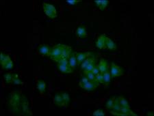 PFKFB4 Antibody - Immunofluorescence staining of HepG2 cells at a dilution of 1:200, counter-stained with DAPI. The cells were fixed in 4% formaldehyde, permeabilized using 0.2% Triton X-100 and blocked in 10% normal Goat Serum. The cells were then incubated with the antibody overnight at 4 °C.The secondary antibody was Alexa Fluor 488-congugated AffiniPure Goat Anti-Rabbit IgG (H+L) .