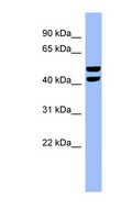 PFKFB4 Antibody - PFKFB4 antibody Western blot of HepG2 cell lysate. This image was taken for the unconjugated form of this product. Other forms have not been tested.