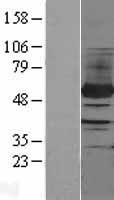 PFKFB4 Protein - Western validation with an anti-DDK antibody * L: Control HEK293 lysate R: Over-expression lysate