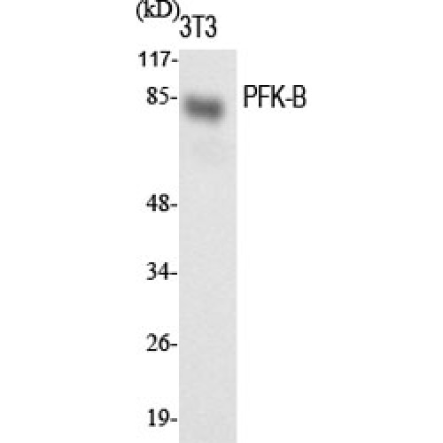PFKL Antibody - Western blot of PFK-B antibody
