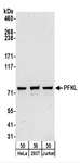 PFKL Antibody - Detection of Human PFKL by Western Blot. Samples: Whole cell lysate (50 ug) from HeLa, 293T, and Jurkat cells. Antibodies: Affinity purified rabbit anti-PFKL antibody used for WB at 0.4 ug/ml. Detection: Chemiluminescence with an exposure time of 3 minutes.