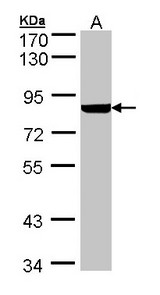 PFKL Antibody - Sample (30 ug of whole cell lysate). A: Hep G2 . 7.5% SDS PAGE. PFKL antibody diluted at 1:1000