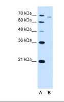 PFKL Antibody - Lane A: Marker. Lane B: HepG2 cell lysate. Antibody concentration: 2.5 ug/ml. Gel concentration: 12%.  This image was taken for the unconjugated form of this product. Other forms have not been tested.