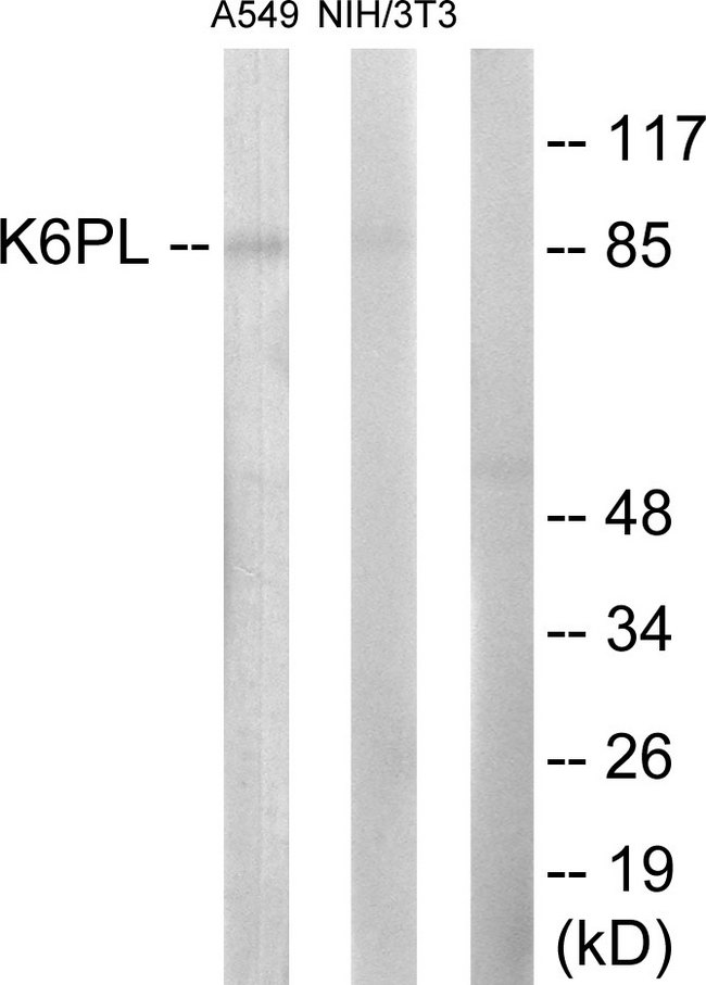 PFKL Antibody - Western blot analysis of lysates from A549 and NIH/3T3 cells, using K6PL Antibody. The lane on the right is blocked with the synthesized peptide.