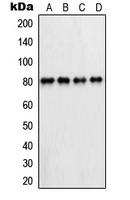 PFKL Antibody - Western blot analysis of PFKL expression in HepG2 (A); A431 (B); Raw264.7 (C); PC12 (D) whole cell lysates.