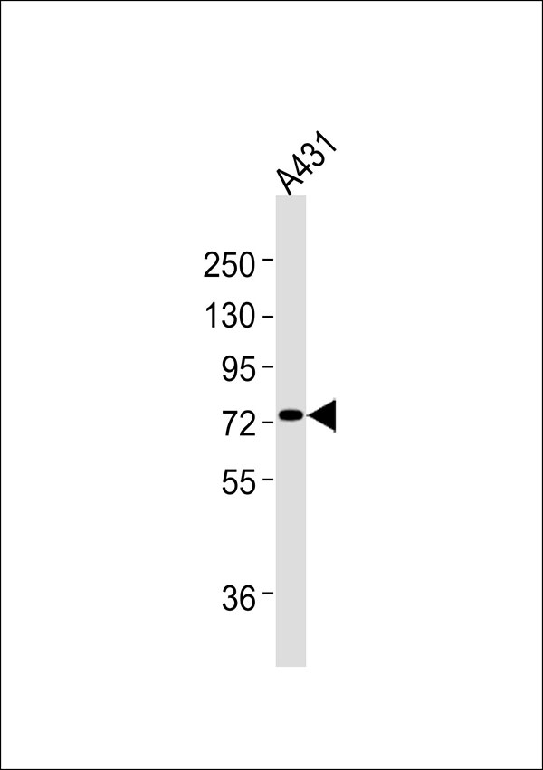 PFKL Antibody - Anti-PFKL Antibody at 1:1000 dilution + A431 whole cell lysates Lysates/proteins at 20 ug per lane. Secondary Goat Anti-Rabbit IgG, (H+L),Peroxidase conjugated at 1/10000 dilution Predicted band size : 85 kDa Blocking/Dilution buffer: 5% NFDM/TBST.
