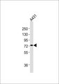 PFKL Antibody - Anti-PFKL Antibody at 1:1000 dilution + A431 whole cell lysates Lysates/proteins at 20 ug per lane. Secondary Goat Anti-Rabbit IgG, (H+L),Peroxidase conjugated at 1/10000 dilution Predicted band size : 85 kDa Blocking/Dilution buffer: 5% NFDM/TBST.