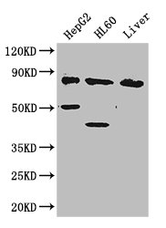 PFKL Antibody - Positive WB detected in:HepG2 whole cell lysate,HL60 whole cell lysate,Mouse liver tissue;All lanes: PFKL antibody at 2.8ug/ml;Secondary;Goat polyclonal to rabbit IgG at 1/50000 dilution;Predicted band size: 86,91 kDa;Observed band size: 86,50,40 kDa;