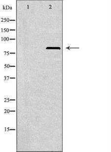 PFKL Antibody - Western blot analysis of extracts of A549 cells using K6PL antibody. The lane on the left is treated with the antigen-specific peptide.