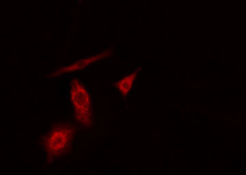 PFKL Antibody - Staining A549 cells by IF/ICC. The samples were fixed with PFA and permeabilized in 0.1% Triton X-100, then blocked in 10% serum for 45 min at 25°C. The primary antibody was diluted at 1:200 and incubated with the sample for 1 hour at 37°C. An Alexa Fluor 594 conjugated goat anti-rabbit IgG (H+L) antibody, diluted at 1/600, was used as secondary antibody.