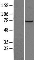 PFKL Protein - Western validation with an anti-DDK antibody * L: Control HEK293 lysate R: Over-expression lysate